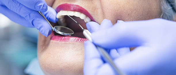 Best Broken or Cracked Tooth Emergency Dentist in Hot Springs, SD